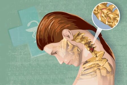 Các triệu chứng phản xạ của xương khớp